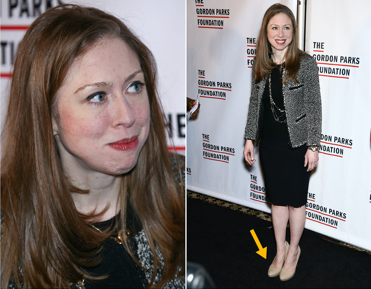 Chelsea Clinton was ripped for wearing the “destroyed” nude heels.<em> (Photos: Splash News)</em>