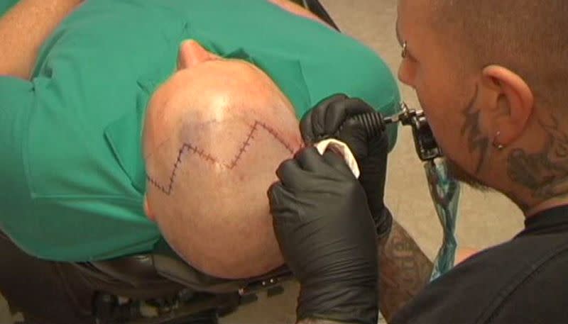 Jeremy Cortner en train de se faire tatouer pour avoir les mêmes cicatrices que son fils. (Photo : WQOW/CNN)