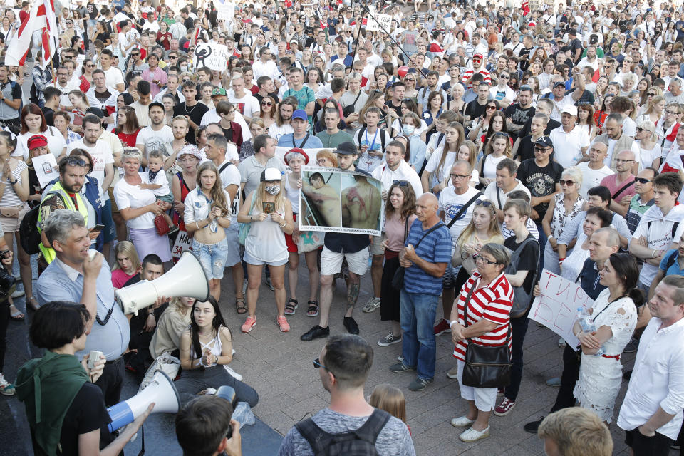 A man holds a poster showing photos of a protester allegedly beaten by police as people gather for a rally in Minsk, Belarus, Monday, Aug. 17, 2020. Belarussian President Alexander Lukashenko said the country could only have a new presidential election after approving an amended version of its constitution, an apparent bid to buy some time amid the growing political crisis. (AP Photo/Dmitri Lovetsky)