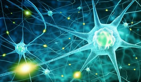 <span class="caption">In patients with MS, the body's immune system attacks the nerve cells.</span> <span class="attribution"><a class="link " href="https://www.shutterstock.com/image-illustration/nerve-cells-291476537" rel="nofollow noopener" target="_blank" data-ylk="slk:adike/ Shutterstock;elm:context_link;itc:0;sec:content-canvas">adike/ Shutterstock</a></span>