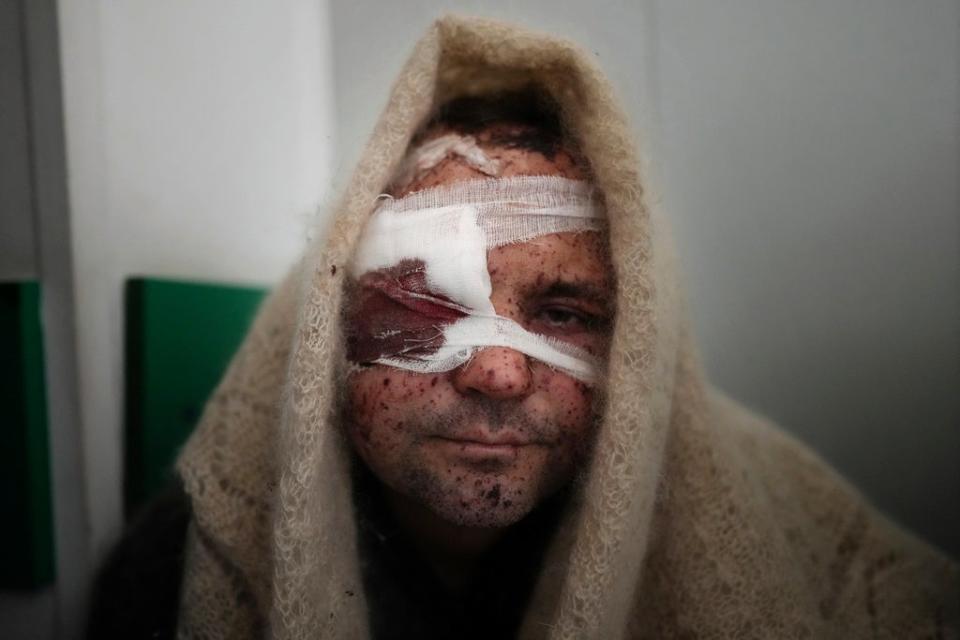 Serhiy Kralya, 41, looks at the camera after surgery at a hospital in Mariupol, eastern Ukraine (AP)