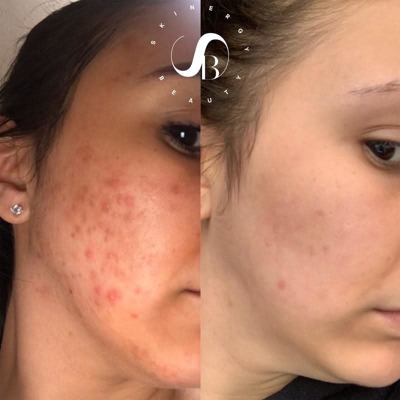 It'll help tame stubborn acne scars, sun spots and hyperpigmentation. <br /><br /><a href="https://go.skimresources.com?id=38395X987171&amp;xs=1&amp;url=https%3A%2F%2Fskinergybeauty.com%2F&amp;xcust=HPBasicBeauty607dad6fe4b0bc5a3a5a7609" target="_blank" rel="noopener noreferrer">Skinergy Beauty</a> is a Latina-owned business started by Priscilla Jiminian, who struggled to find skin care that catered to skin like hers. After a trip to the Dominican Republic, she entered the skin care industry with the goal of creating products inclusive of all skin types.<br /><br /><strong>Promising review:</strong> "I suck at not picking my pimples and of course it tends to leave a dark spot. <strong>This cream will seriously work within days! It&rsquo;s truly mind-blowing.</strong> I cannot thank the CEO enough for bringing this cream into my life! I&rsquo;ve been using it for years and recommend it to everyone I can. I have yet to hear anyone tell me they hate it." &mdash; <a href="https://go.skimresources.com?id=38395X987171&amp;xs=1&amp;url=https%3A%2F%2Fskinergybeauty.com%2Fcollections%2Fcollection%2Fproducts%2Fdark-spot-correcting-cream&amp;xcust=HPBasicBeauty607dad6fe4b0bc5a3a5a7609" target="_blank" rel="nofollow noopener noreferrer" data-skimlinks-tracking="5909265|xid:fr1618928480280adg" data-vars-affiliate="skinergybeauty.com" data-vars-href="https://skinergybeauty.com/collections/collection/products/dark-spot-correcting-cream" data-vars-keywords="fast fashion" data-vars-link-id="16577505" data-vars-price="" data-vars-product-id="21059033" data-vars-product-img="https://cdn.shopify.com/s/files/1/0364/1035/9940/products/skin02_400x.png?v=1589234157" data-vars-product-title="Dark Spot Correcting Cream" data-vars-retailers="" data-ml-dynamic="true" data-ml-dynamic-type="sl" data-orig-url="https://skinergybeauty.com/collections/collection/products/dark-spot-correcting-cream" data-ml-id="32">Areidy M</a><br /><br /><strong>Get it from Skinergy Beauty for <a href="https://go.skimresources.com?id=38395X987171&amp;xs=1&amp;url=https%3A%2F%2Fskinergybeauty.com%2Fcollections%2Fcollection%2Fproducts%2Fdark-spot-correcting-cream&amp;xcust=HPBasicBeauty607dad6fe4b0bc5a3a5a7609" target="_blank" rel="nofollow noopener noreferrer" data-skimlinks-tracking="5909265|xid:fr1618928480280iae" data-vars-affiliate="skinergybeauty.com" data-vars-href="https://skinergybeauty.com/collections/collection/products/dark-spot-correcting-cream" data-vars-keywords="fast fashion" data-vars-link-id="16577505" data-vars-price="" data-vars-product-id="21059033" data-vars-product-img="https://cdn.shopify.com/s/files/1/0364/1035/9940/products/skin02_400x.png?v=1589234157" data-vars-product-title="Dark Spot Correcting Cream" data-vars-retailers="" data-ml-dynamic="true" data-ml-dynamic-type="sl" data-orig-url="https://skinergybeauty.com/collections/collection/products/dark-spot-correcting-cream" data-ml-id="33">$54.99</a>.</strong>