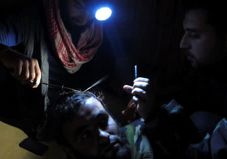 FILE PHOTO: A member of the Free Syrian Army receives treatment for a head injury near the town of Atareb, Syria November 18, 2012. REUTERS/Abdalghne Karoof/File Photo