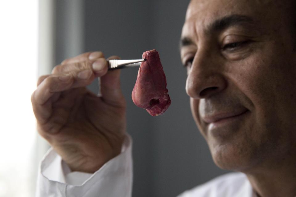 Professor Alexander Seifalian poses for photographs with a synthetic polymer nose at his research facility in the Royal Free Hospital in London, Monday, March 31, 2014. In a north London hospital, scientists are growing noses, ears and blood vessels in the laboratory in a bold attempt to make body parts using stem cells. It is among several labs around the world, including in the U.S., that are working on the futuristic idea of growing custom-made organs in the lab. While only a handful of patients have received the British lab-made organs so far— including tear ducts, blood vessels and windpipes — researchers hope they will soon be able to transplant more types of body parts into patients, including what would be the world's first nose made partly from stem cells. "It's like making a cake," said Alexander Seifalian at University College London, the scientist leading the effort. "We just use a different kind of oven." (AP Photo/Matt Dunham)