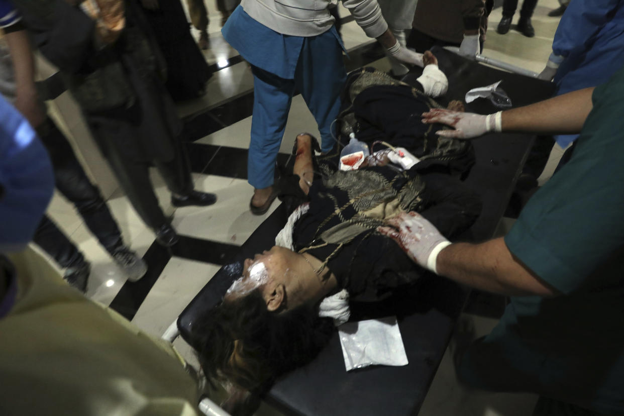 An injured school student is transported to a hospital after a bomb explosion near a school in west of Kabul, Afghanistan, Saturday, May 8, 2021. A bomb exploded near a school in west Kabul on Saturday, killing several people, many them young students, an Afghan government spokesmen said. (AP Photo/Rahmat Gul)