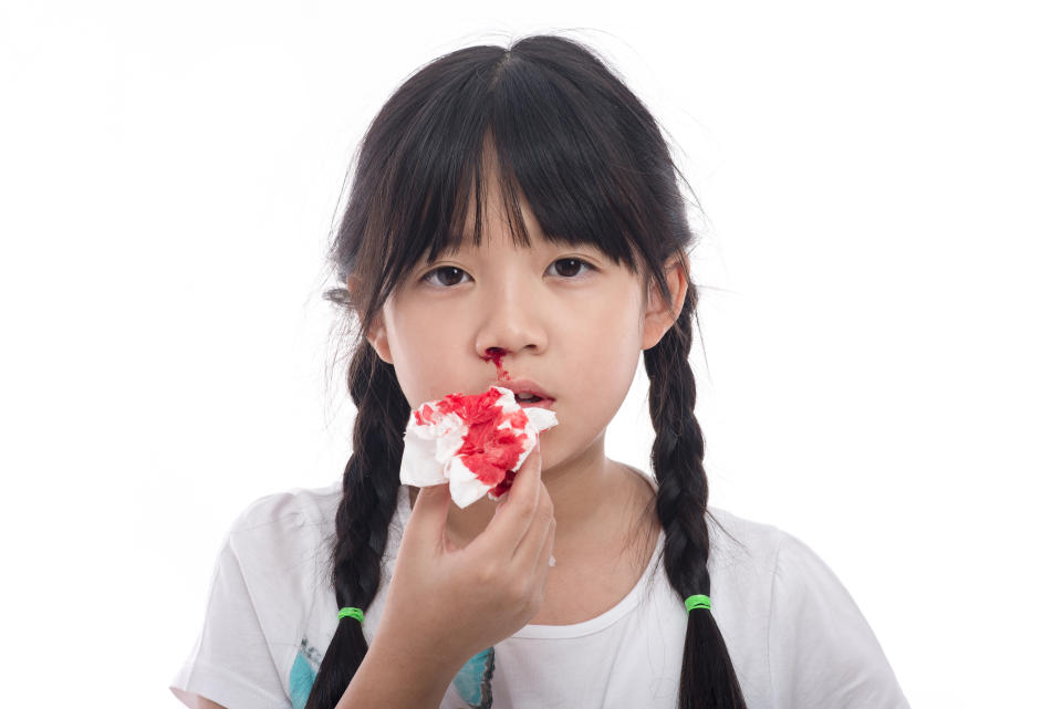 Asian girl with bleeding from the nose on white background isolated