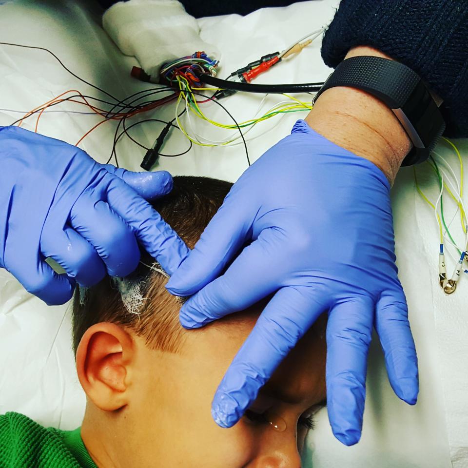 The author’s son getting hooked up for an EEG. (Photo courtesy of Eden Strong)