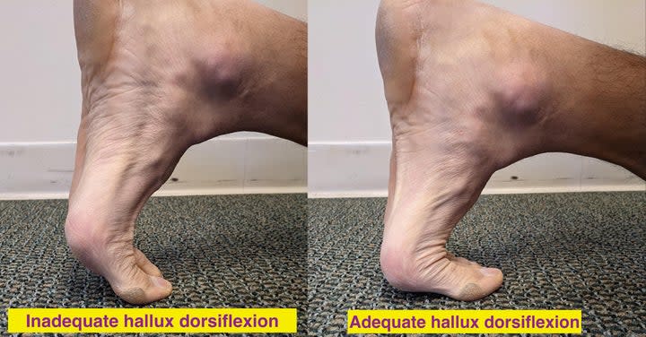 halux dorsiflexion assessment