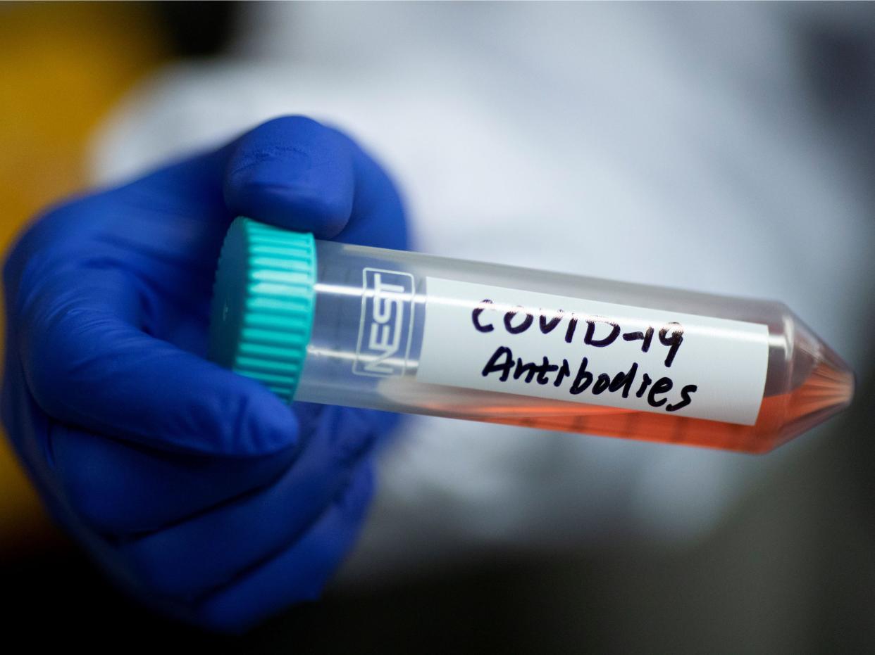 FILE PHOTO: Scientist Linqi Zhang shows a tube with a solution containing COVID-19 antibodies in his lab where he works on research into novel coronavirus disease (COVID-19) antibodies for possible use in a drug at Tsinghua University's Research Center for Public Health in Beijing, China, March 30, 2020.  REUTERS/Thomas Peter