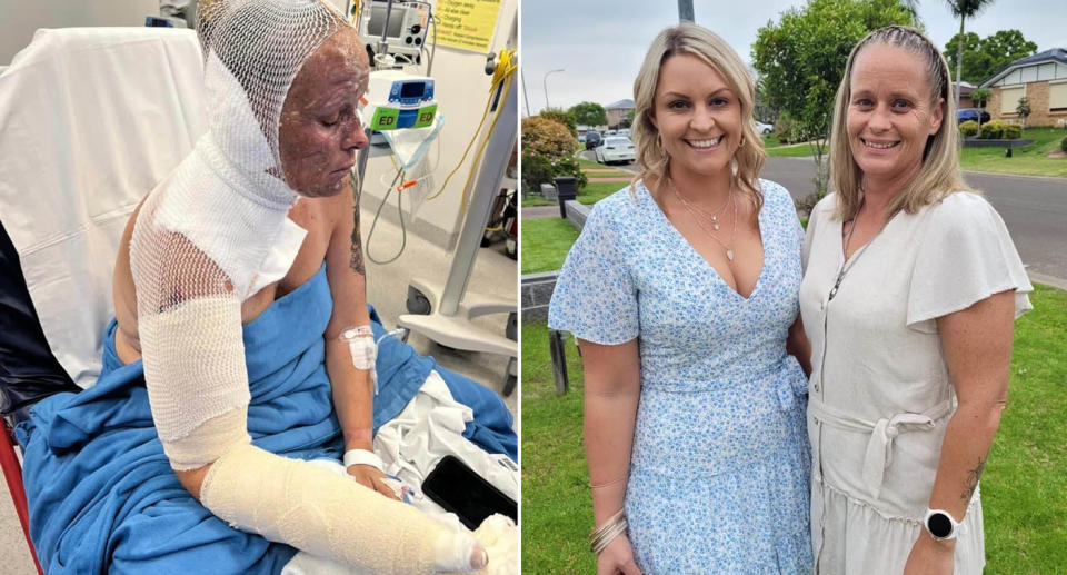 Anita Ferguson, 38, in hospital after second-degree burn (left) Anita Ferguson with twin sister Jenna (right).