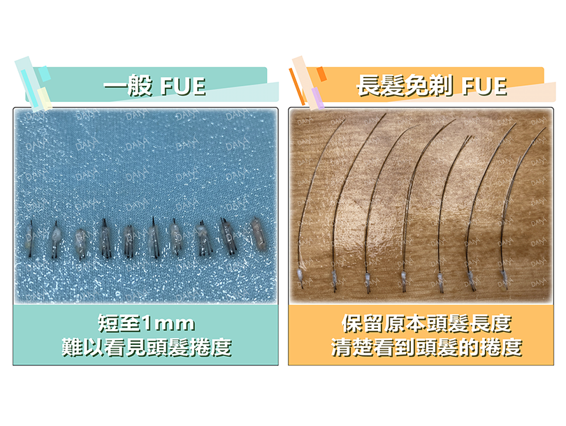 一般FUE與長髮免剃FUE毛囊比較