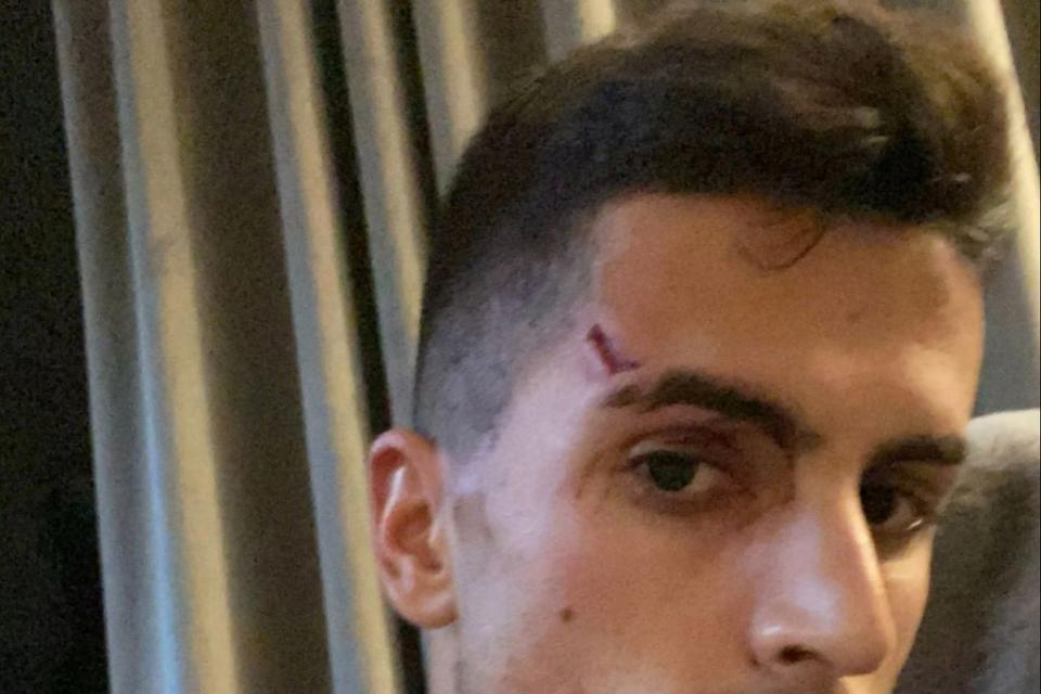  (Instagram @jpcancelo)