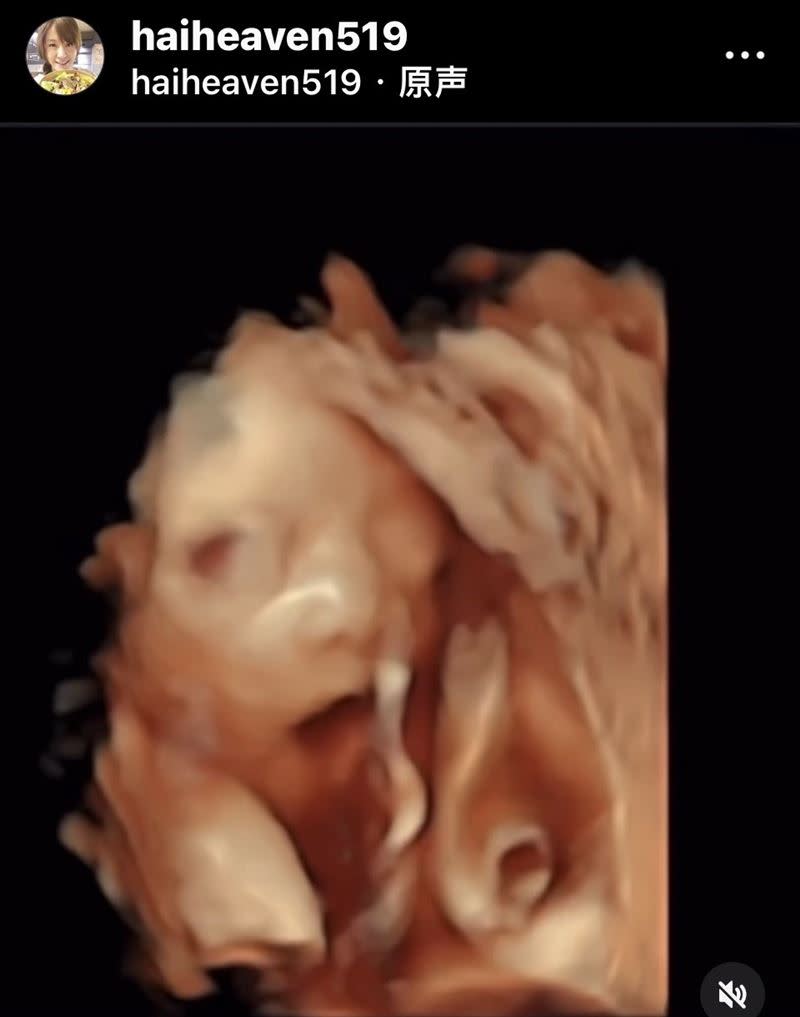 海芬曬出寶寶超音波影片。（圖／海芬 IG）