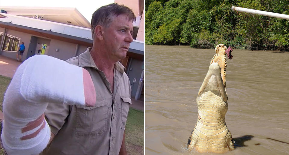 Shane Dearly was attacked by a crocodile while on a boat in the Northern Territory. Source: Nine News/AAP