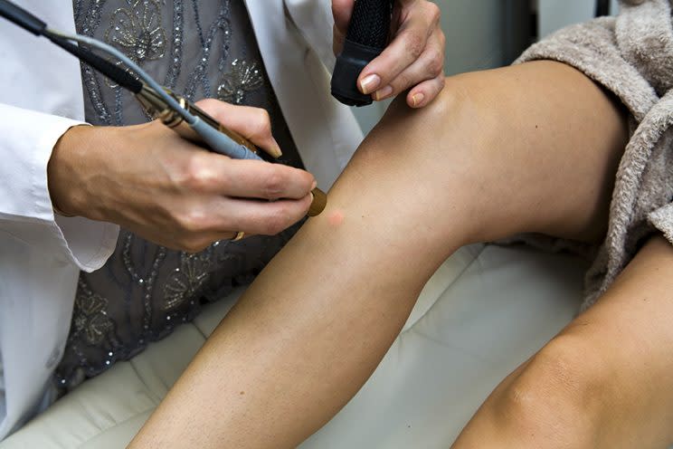 A new procedure to remove birthmarks and tattoos combines ultrasound with laser light