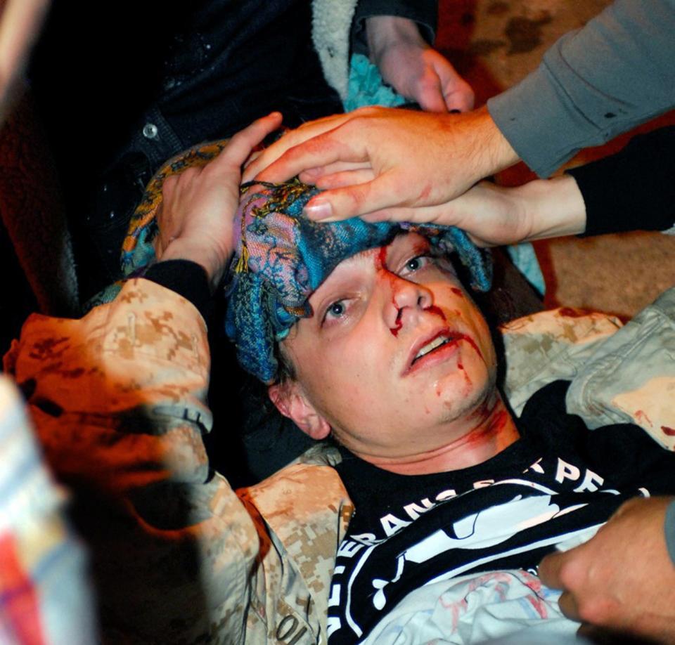 On Oct. 25, 2011, 24-year-old Iraq War veteran Scott Olsen lies on the ground bleeding from a head wound after being struck by a projectile during an Occupy Wall Street protest in Oakland, California.
