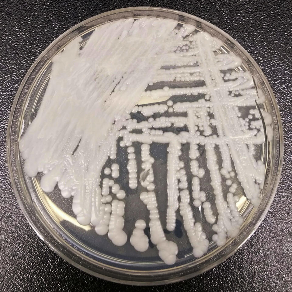Un cultivo del hongo Candida auris en el laboratorio del CDC. (CDC via AP)