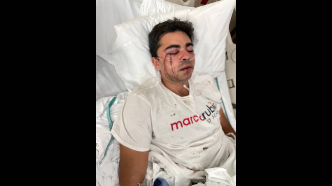 Christopher Monzon was attacked Sunday in Hialeah while canvassing for the Republican Party of Florida.