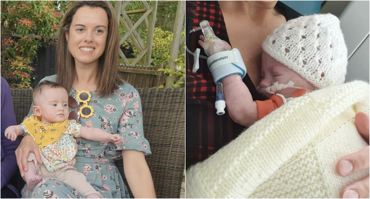 Jessy Williams gave birth to one of the UK's smallest babies, Sky (now 15 months).