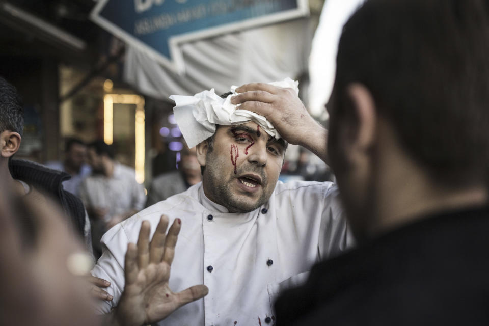 <p>A restaurant worker, wounded in a rocket attack, fired from inside Syria, walks to an ambulance in the border town of Kilis, Turkey, Thursday, Feb. 1, 2018. Kilis and the town of Reyhanli, both of which border Afrin, Syria, have been the target of multiple rocket attacks that have killed at least four people, including a teenage girl and injured dozens of others. (Photo: Can Erok/DHA-Depo Photos via AP) </p>