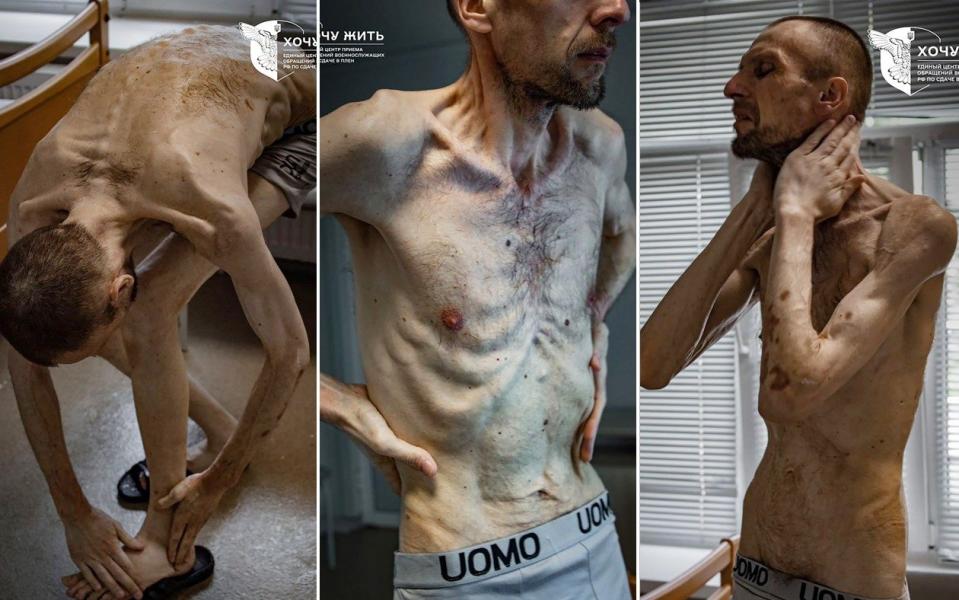 Roman Gorilyk was left with a bruised, skeletal body after suffering under the hands of Russian forces