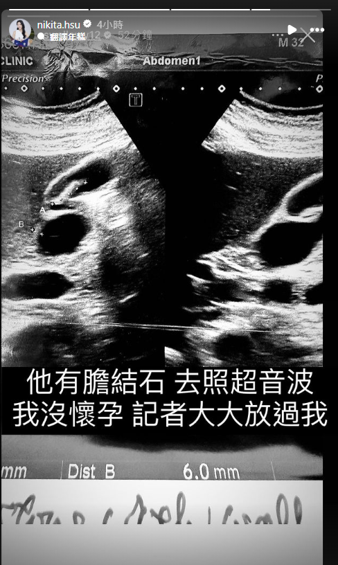 許美中曬超音波照，舒子晨急否認懷孕。（圖／翻攝自舒子晨IG）