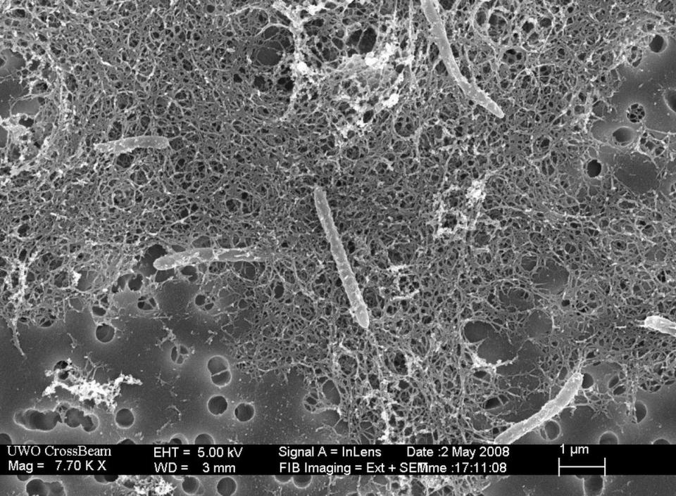 A colony of <em>Candidatus Desulforudis audaxviator</em>, discovered in a 1.7-mile-deep (2.8 kilometers) gold mine near Johannesburg, South Africa. <cite>Public Domain, via Wikimedia Commons</cite>