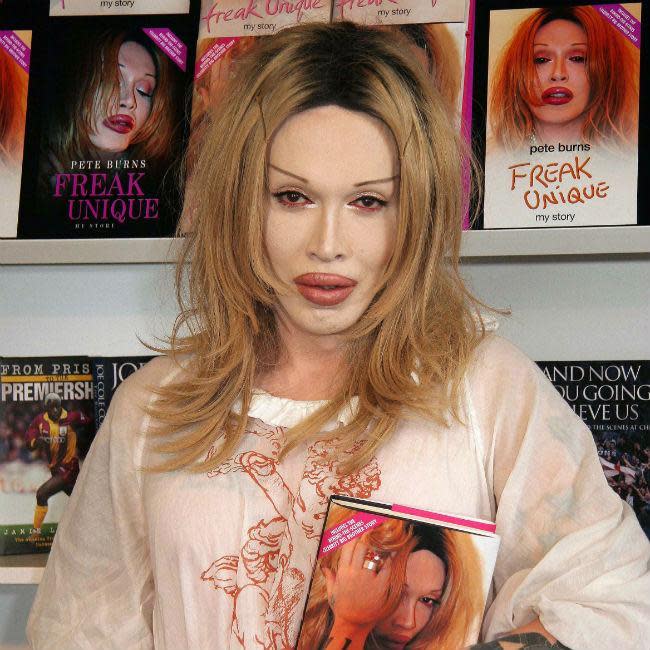 Pete Burns only released one tome in his lifetime, 2006's 'Freak Unique: My Autobiography'.The singer was an open book, writing about his cosmetic addiction and his battle with depression, as well as, his flamboyant style.