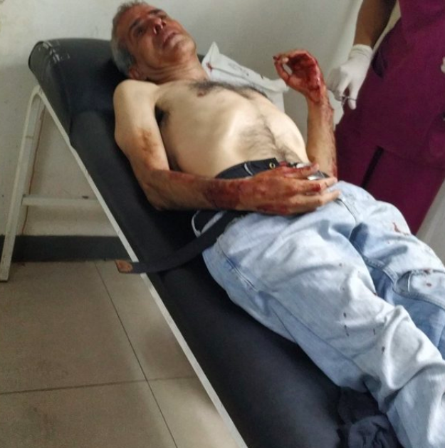 Hombre de 62 años es atendido tras ser atacado por colectivos cuando protestaba por agua y luz en Caracas el 31 de abril 2019 (Captura pantalla Twitter)