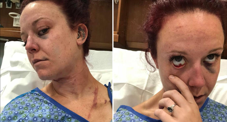 A woman was able to escape when her attacker stopped to look for his glasses she said in a Facebook post.