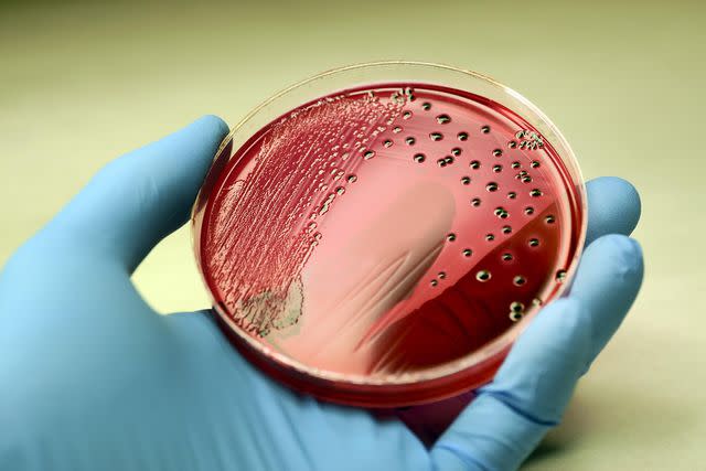 <p>Getty</p> Salmonella petri dish