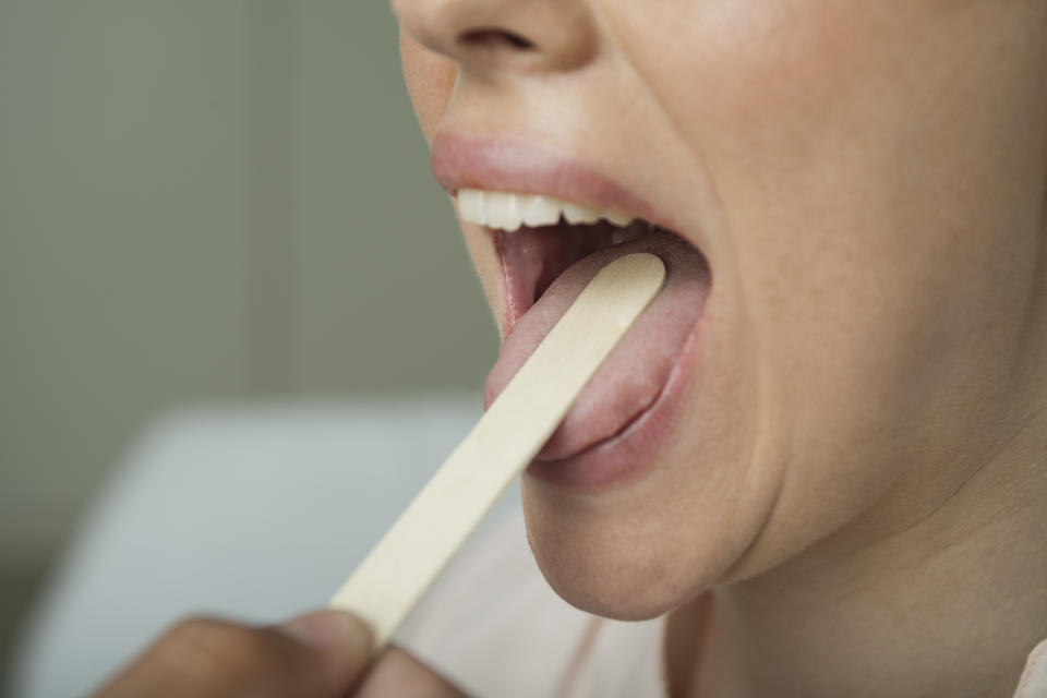 Anecdotal reports of a symptom called "COVID tongue" have been cropping up in Facebook groups, but experts tell Yahoo Life the reaction could be unrelated. (Photo: Getty Images)