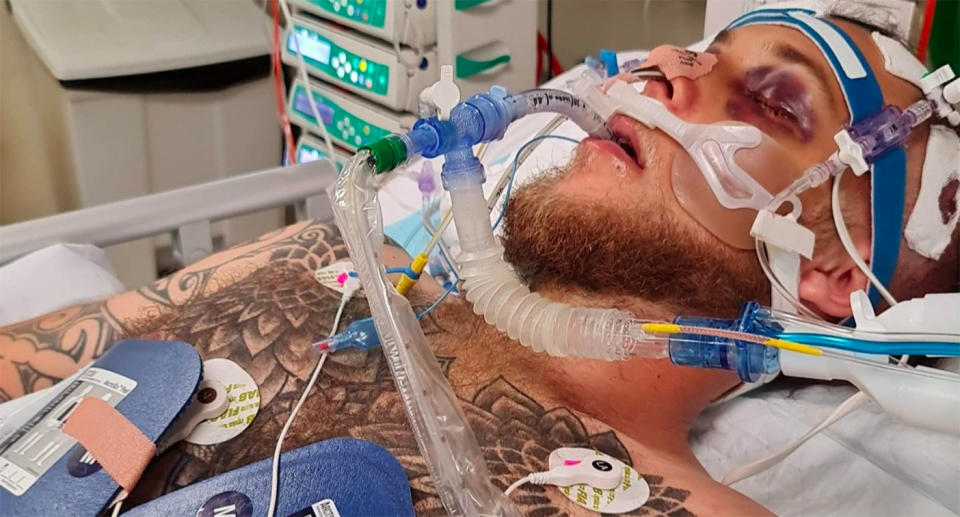 Brandon Orr lies in a hospital bed in a Perth hospital after being bashed outside a pub in Perth.