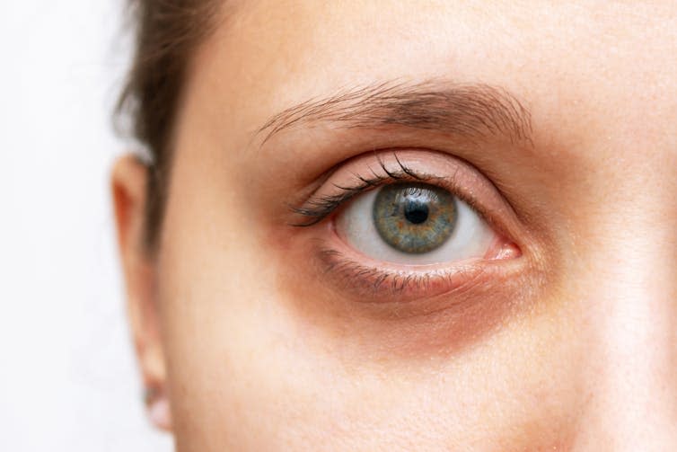 Close up of woman's face