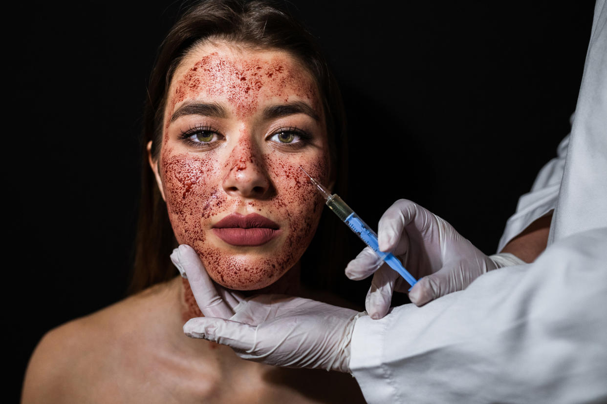 Two clients have reportedly been diagnosed with HIV following a ‘vampire facial’ [Photo: Getty]