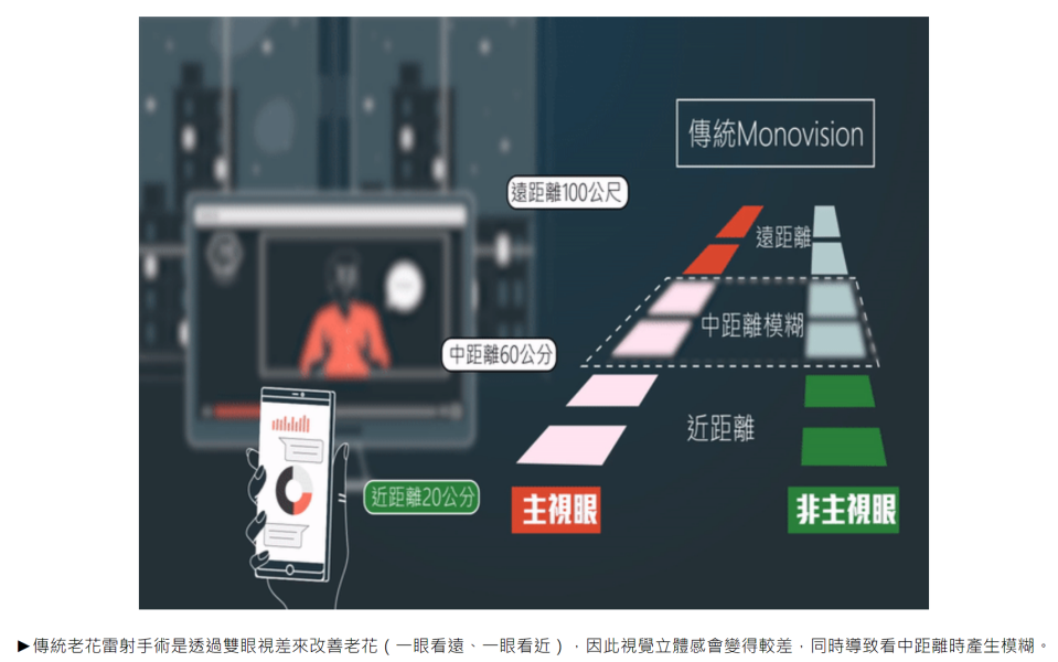 傳統老花雷射 示意圖，中距離視覺較模糊。