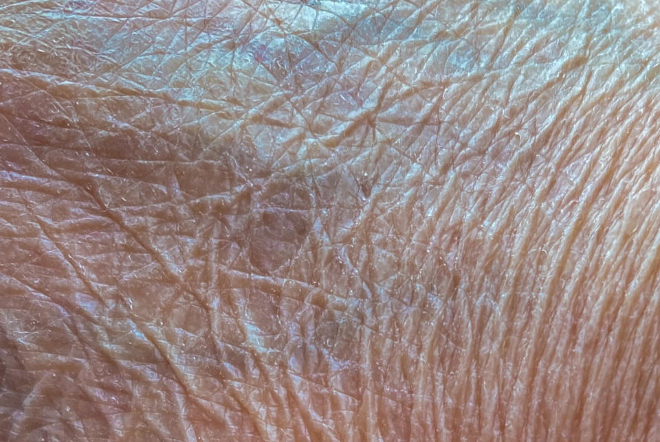 Close-up of wrinkled, textured skin with fine lines and creases visible