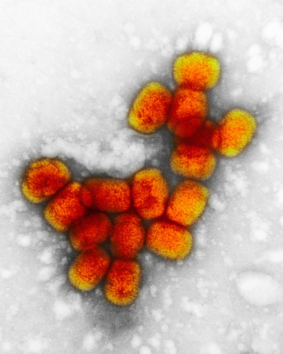 Image: A transmission electron micrograph of smallpox viruses. (Callista Images / Getty Images/Image Source)