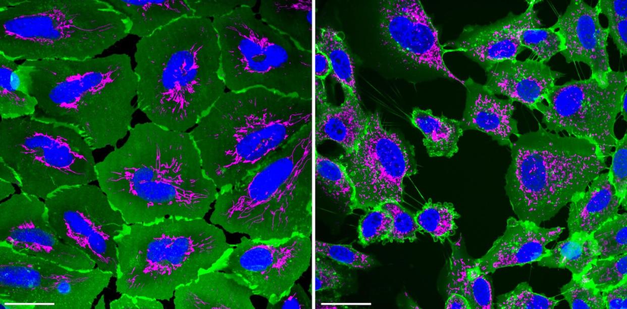 Des cellules de poumon humain cultivées in vitro répondent au stress environnemental (vivantes et saines à gauche et exposées à un poison à droite), et changent de forme et de motifs de connexion. ©Sophie Charrasse / CNRS-ISEM, Fourni par l'auteur