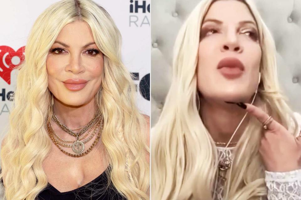 <p>Jesse Grant/Getty Images for iHeartRadio; Tori Spelling/Instagram</p> Tori Spelling on April 1 (Left); Tori Spelling showing off stitches (Right)