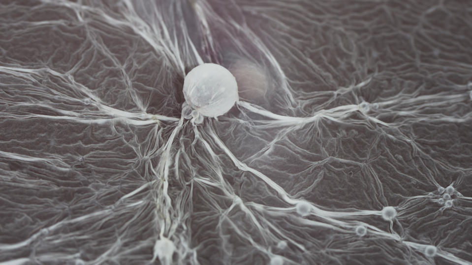 Patterns in a brettanomyces bacterial bloom