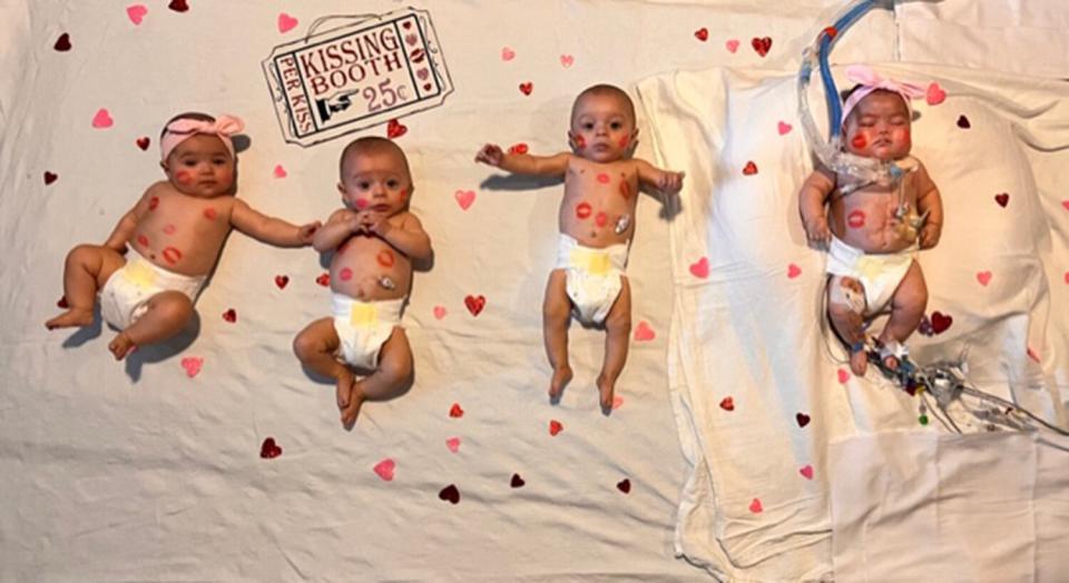 Ashley Ness quadruplets