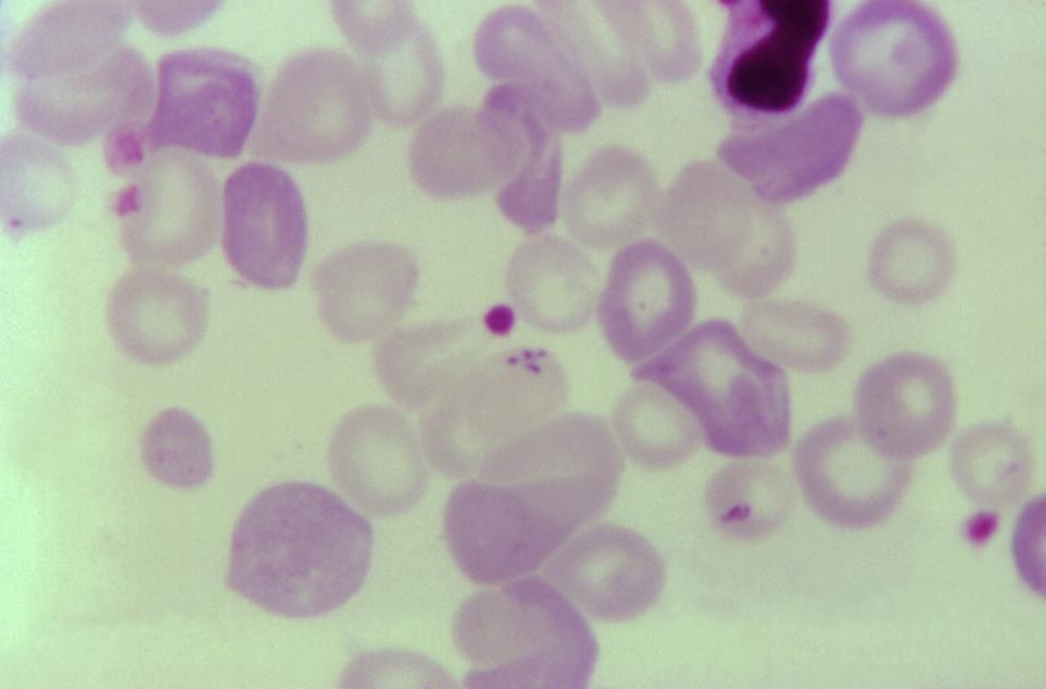 A collection of purple cells, one enlarged with a much darker purple blotch. 