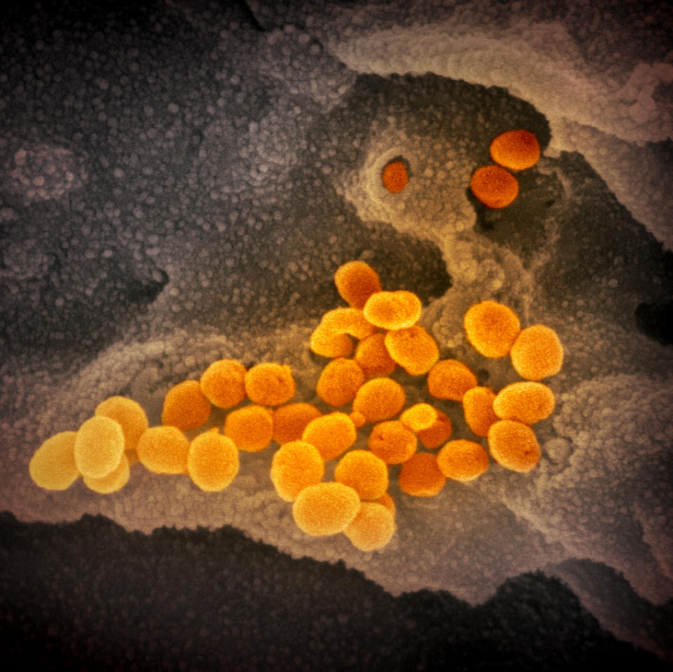 This scanning electron microscope image shows SARS-CoV-2 (orange)—also known as 2019-nCoV, the virus that causes COVID-19—isolated from a patient in the U.S., emerging from the surface of cells (gray) cultured in the lab. (Crédito: NIAID-RML)