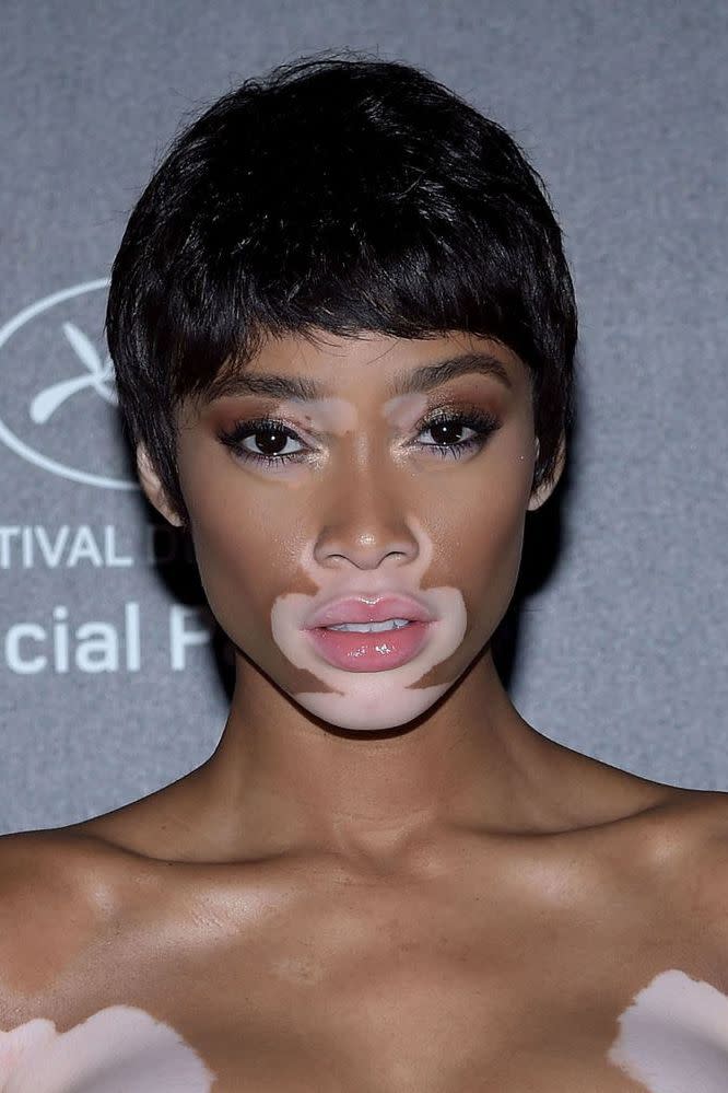 <p>Ok, it might be a wig, but we're all about Winnie Harlow's ode to the pixie crop.</p>