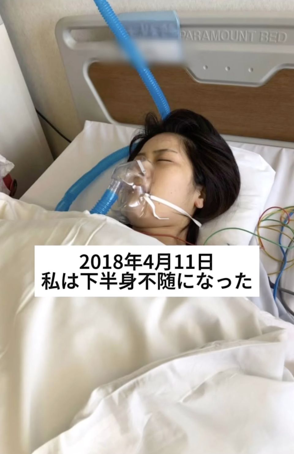 日女星豬狩友香從2018年4月11日被宣布下半身不遂，甚至無法自主排泄。（翻攝豬狩友香INS）