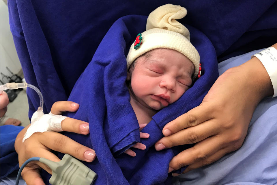 The baby girl was born to a woman with a uterus transplanted from a deceased donor in Sao Paulo, Brazil, last December. Source: Dr Wellington Andraus via AP