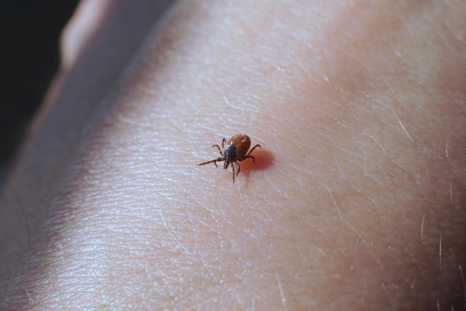 A female blacklegged tick crawling on a person's skin ready to bite. Ticks carry several diseases, and they might be spreading in Canada. (Photo via Getty Images)