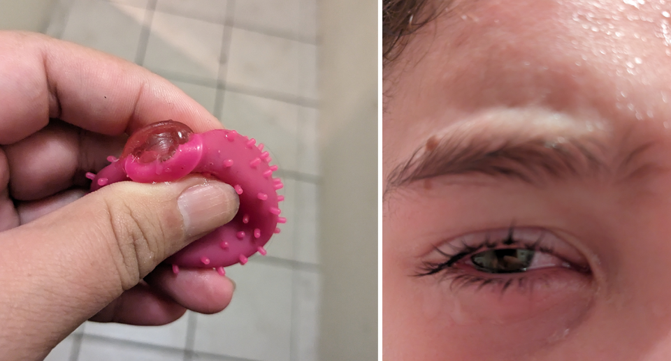 Pictured is a pink 'squishy' Kmart sensory ball toy, beside an image of a seven-year-old boy's eye that was injured by it. 