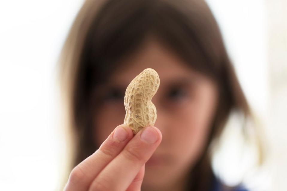 An estimated 20 million Americans have food allergies, the most common being shellfish, milk, eggs, fish, peanuts, tree nuts, sesame, soy and wheat. Getty Images/iStockphoto